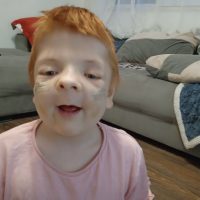 UPDATE 25.08.2025 – Elena a trecut prin a doua intervenție în Turcia